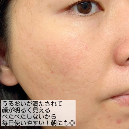 ルルルン ハイドラ V マスク/ルルルン/シートマスク・パックを使ったクチコミ(6枚目)