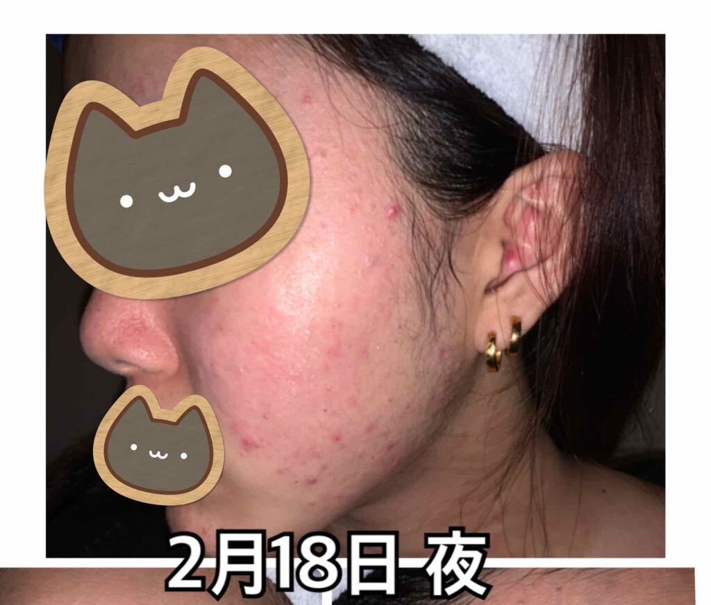 プロポリス エネルギーアンプル/CNP Laboratory/美容液を使ったクチコミ(2枚目)