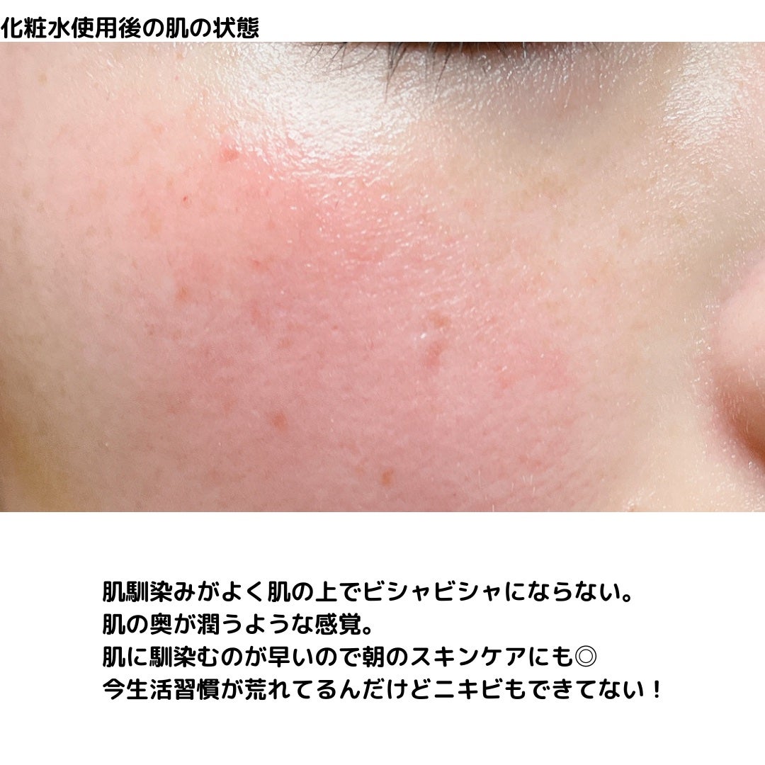 ホリーディア モイストディープアクア/HOLIDEA/化粧水を使ったクチコミ(6枚目)