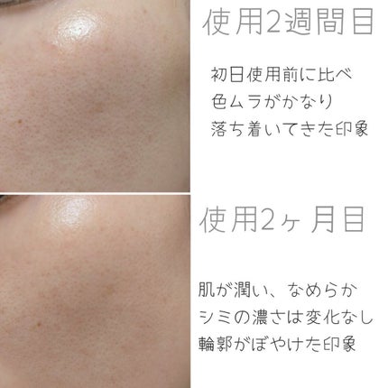 ハイドロクリームPHQ-8/KISO/美容液を使ったクチコミ(3枚目)