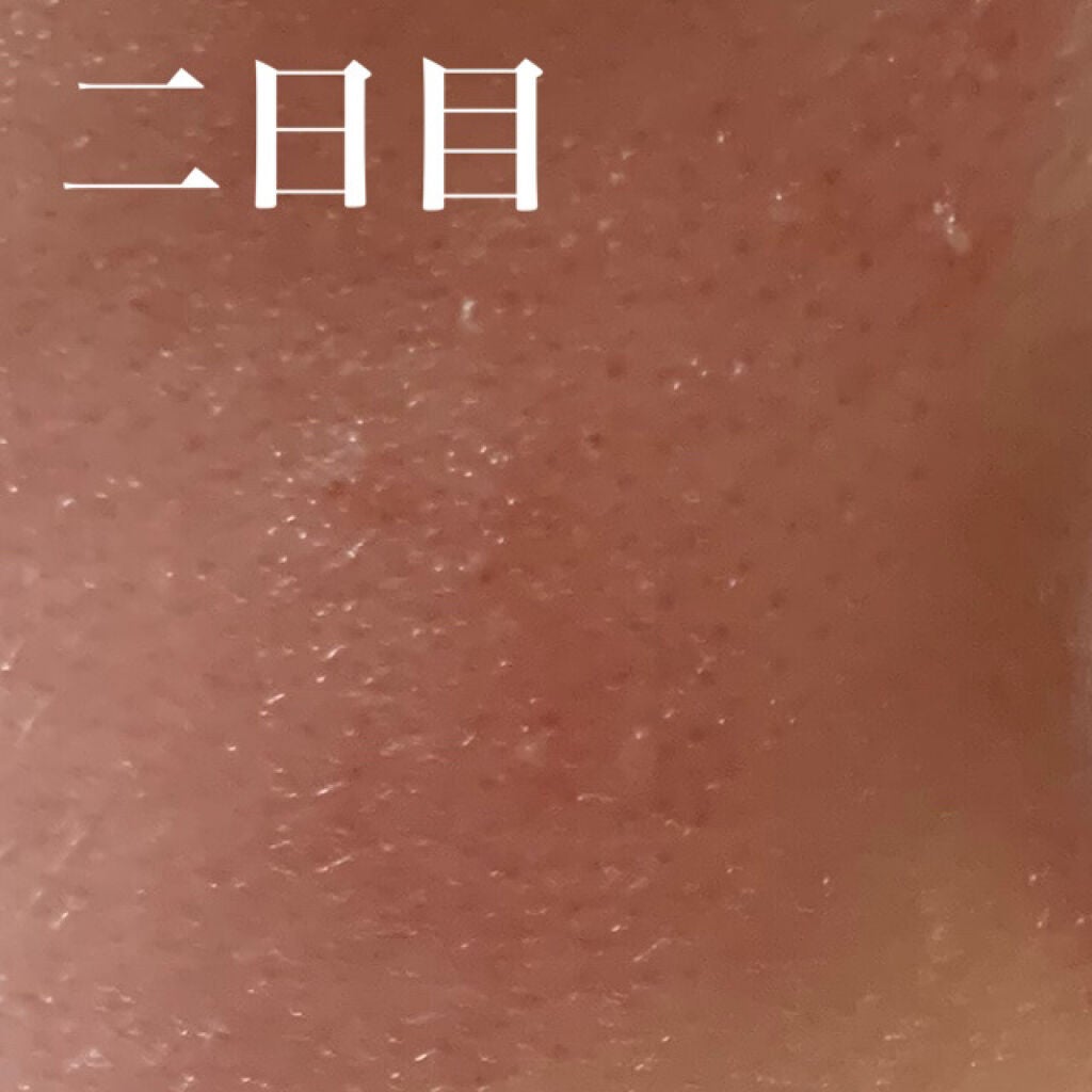 ホワイトニングクリア セット/d プログラム/スキンケアキットを使ったクチコミ(4枚目)