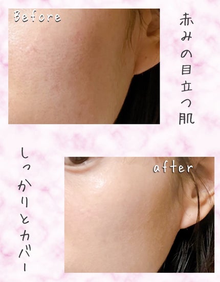 シカレシピセラムクッション/BEAUSTA/クッションファンデーションを使ったクチコミ(1枚目)