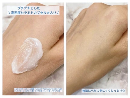 アトバリア365クリーム/AESTURA/フェイスクリームを使ったクチコミ(3枚目)