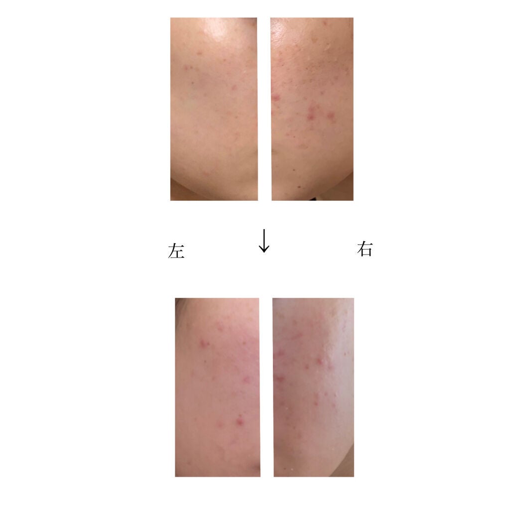 ザ・タイムR アクア/IPSA/化粧水を使ったクチコミ(2枚目)