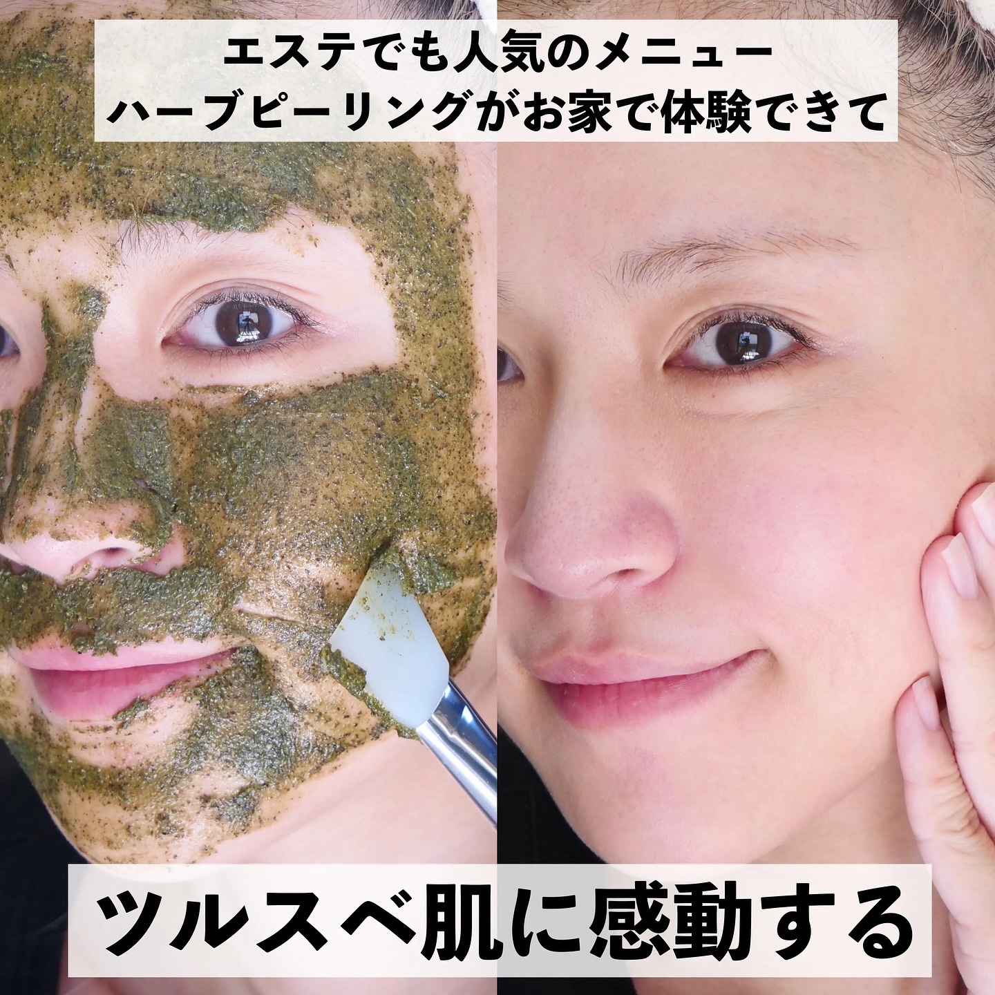 ティーツリーハーブピーリングパック/WellDerma/洗い流すパック・マスクを使ったクチコミ（2枚目）