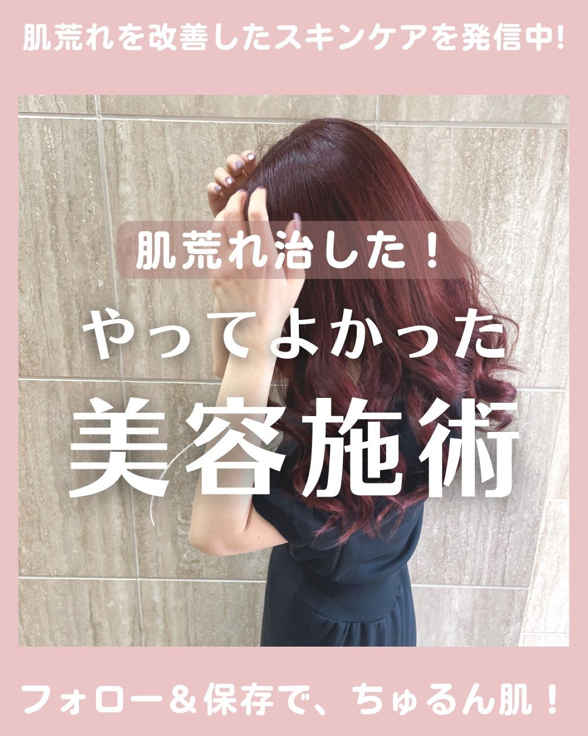 ãªãŒãð«§ãããã»èèããçŸèã« on LIPS ãïœãã£ãŠããã£ãçŸå®¹å»ç5éžâšèèãå°çããããã¡ã³ãæã¡ãã§..ãïŒ1æç®ïŒ