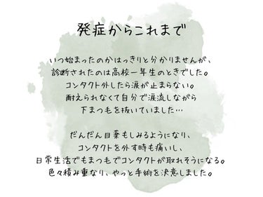 逆さまつげに終止符を打つ！！！

もう我慢できなくなりました！！！！！
眼瞼内反症は手術しないと根本的に直すことはできません。手術が怖くてずっとチキってました🐔

アイプチでまつ毛を貼り付けてみたり、マスカラ塗ってみたり…もちろんやりました！
でも逆らう力は強いんです💪
ヒロインメイクのマスカラも使いました。
まつ毛が勝ちました。
アイプチをしたら無駄にまつ毛が抜けました。

いい加減手術してしまおう。
１回怖い思いすれば、その後楽になるんだ！
と言い聞かせることにしました。

私の仕事は休みを取りやすいので決断しやすかったですが、普通はそうはいかないものですよね。
私の記録を見て、ダウンタイムどれくらいかかるかなど不安要素が減らせたらなと思います✨

#逆さまつげ #まつ毛#下まつ毛#手術#眼瞼内反
#記録#目#ダウンタイムの画像 その1