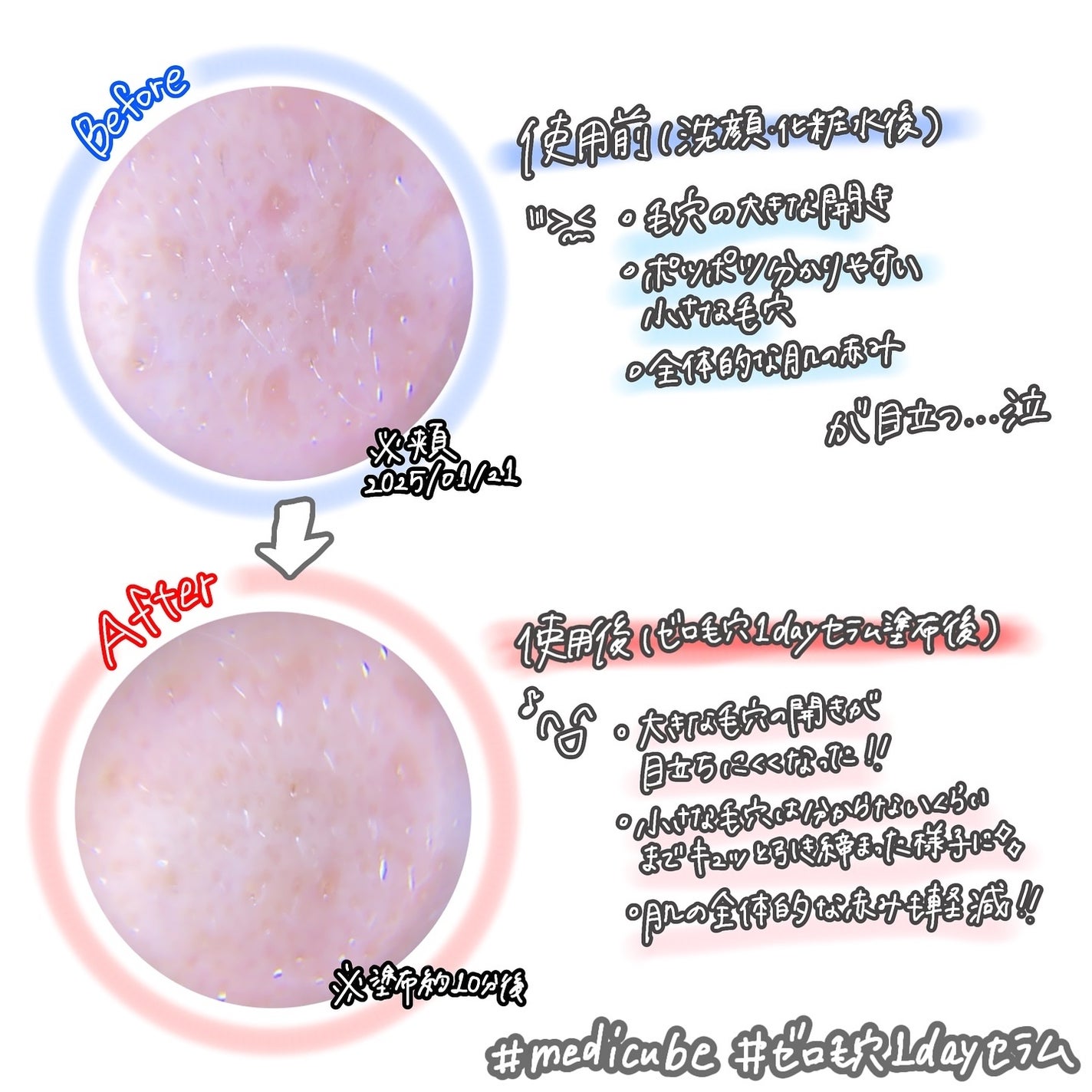 ゼロ毛穴1DAYセラム/MEDICUBE/美容液を使ったクチコミ(3枚目)