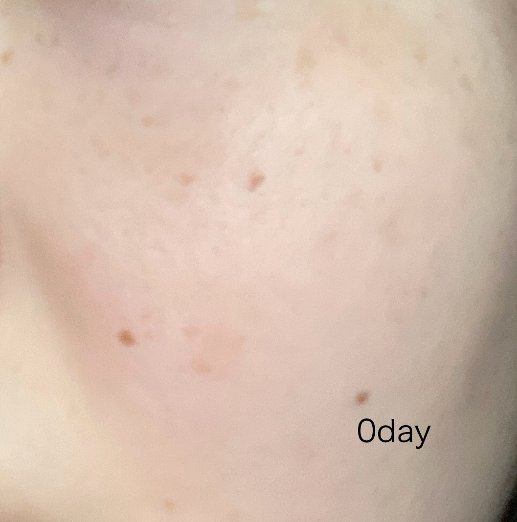 TXトーニングエッセンス1000SHOT/VT/美容液を使ったクチコミ（2枚目）