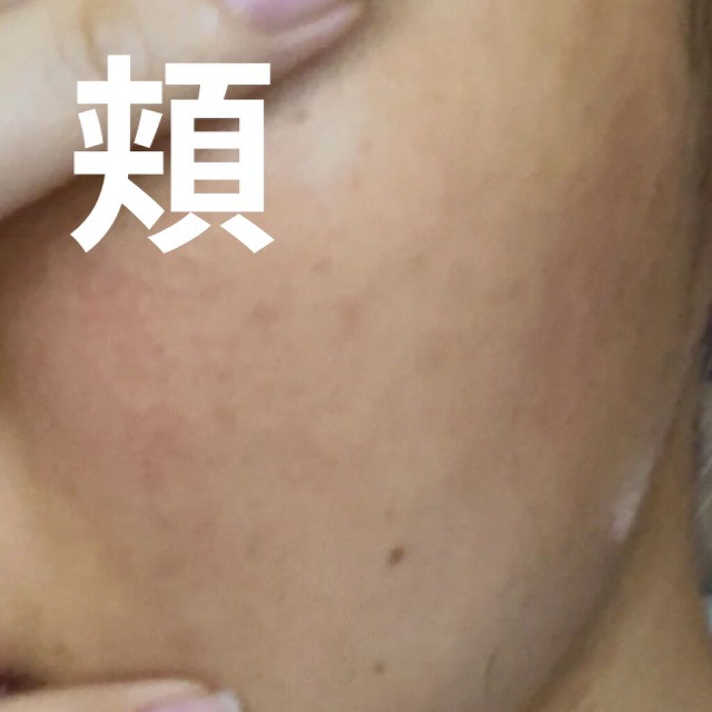 ハトムギ化粧水(ナチュリエ スキンコンディショナー R )/ナチュリエ/化粧水を使ったクチコミ（3枚目）