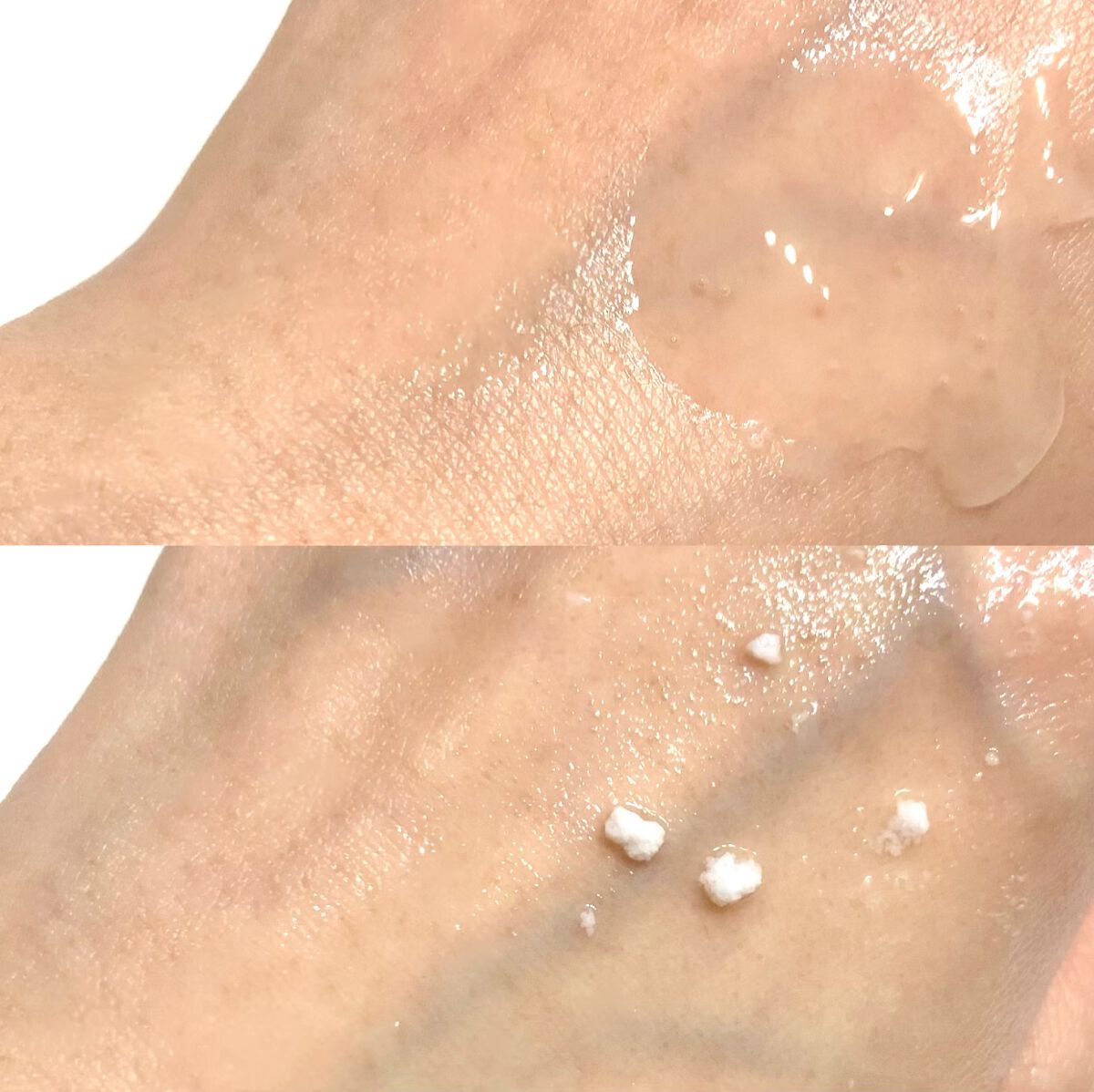 美白乃美人ピーリングジェル/ブレーンコスモス/ピーリングを使ったクチコミ(2枚目)