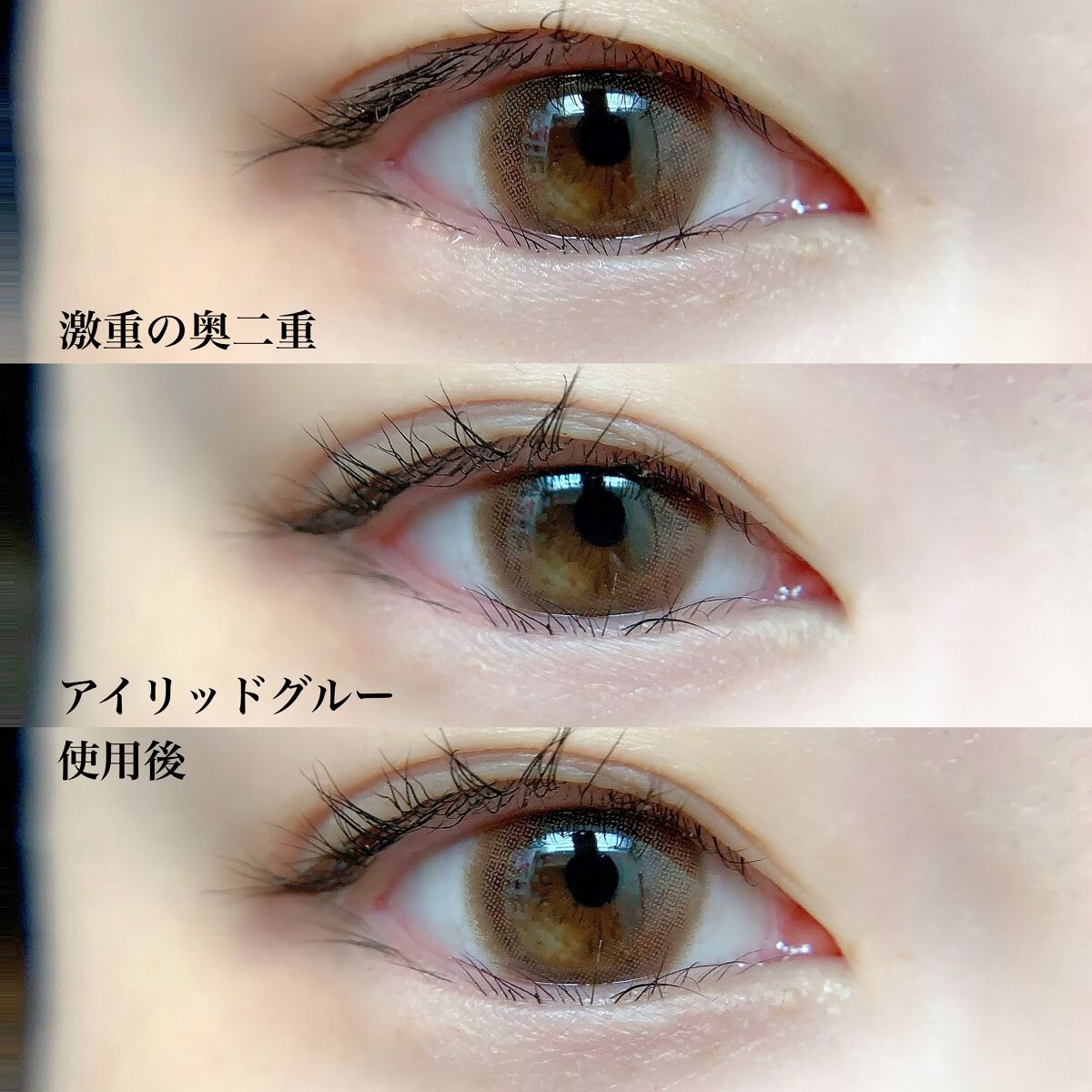 湘南美容アイリッドグルー/湘南美容/二重まぶた用アイテムを使ったクチコミ(4枚目)