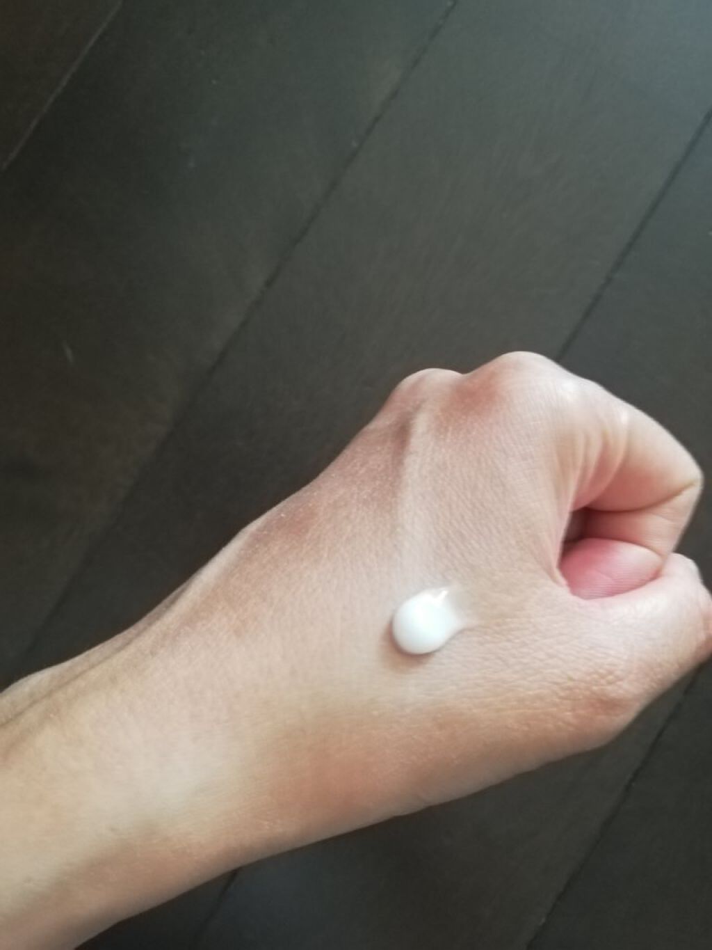 RI♡ on LIPS 「ベピオゲル医薬品ニキビが酷いから皮膚科へ赤みは少なくなったけど..」(2枚目)