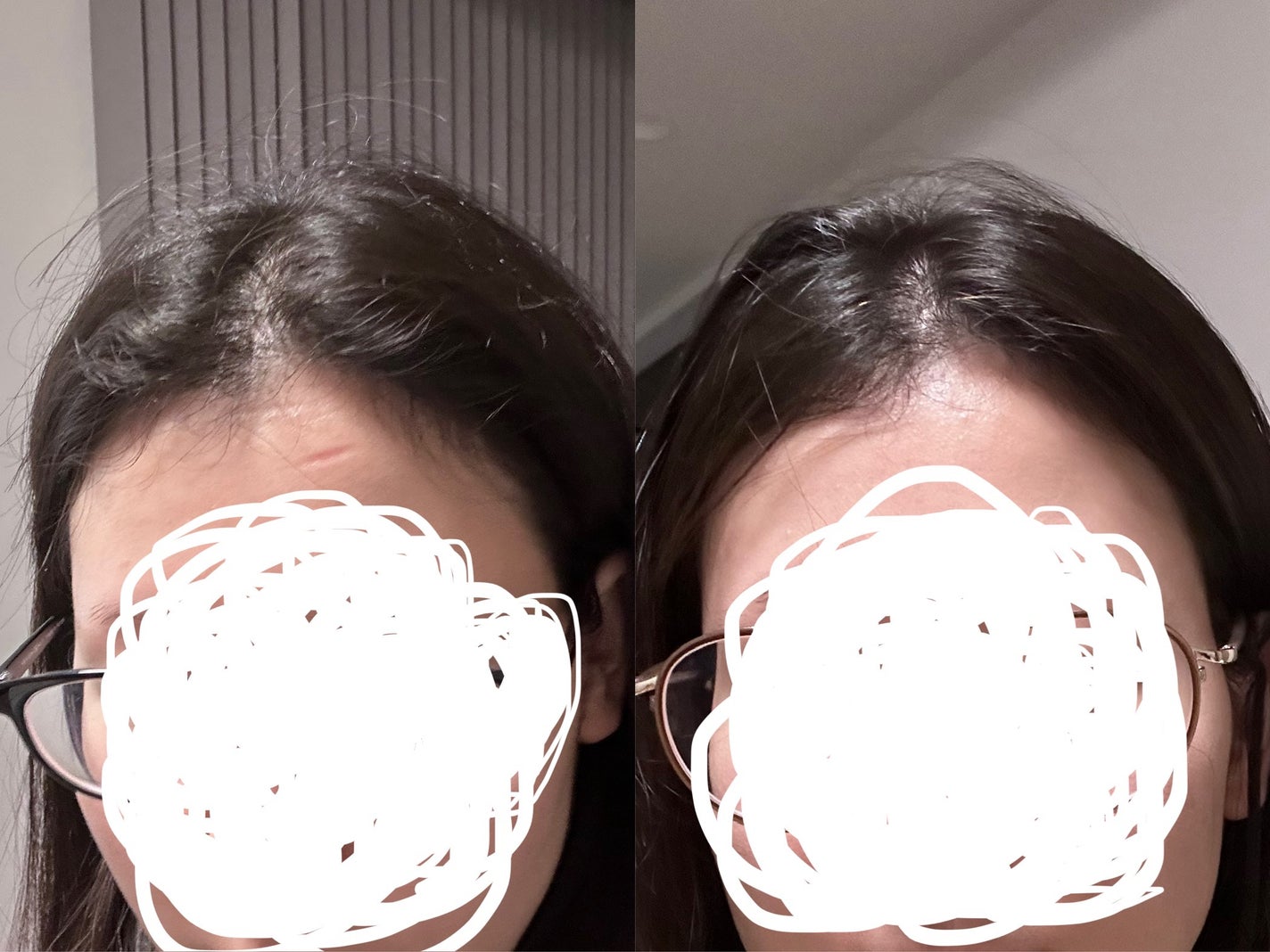 SonoRepro/アンファー(スカルプD)/ヘアケアグッズを使ったクチコミ(2枚目)