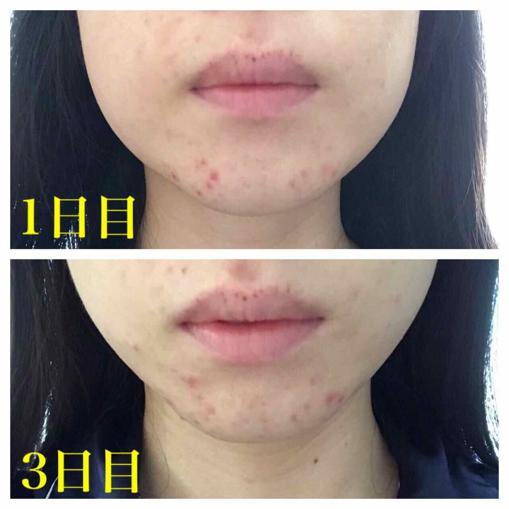 ファイバーフォーム/ルナメアAC/洗顔フォームを使ったクチコミ(3枚目)