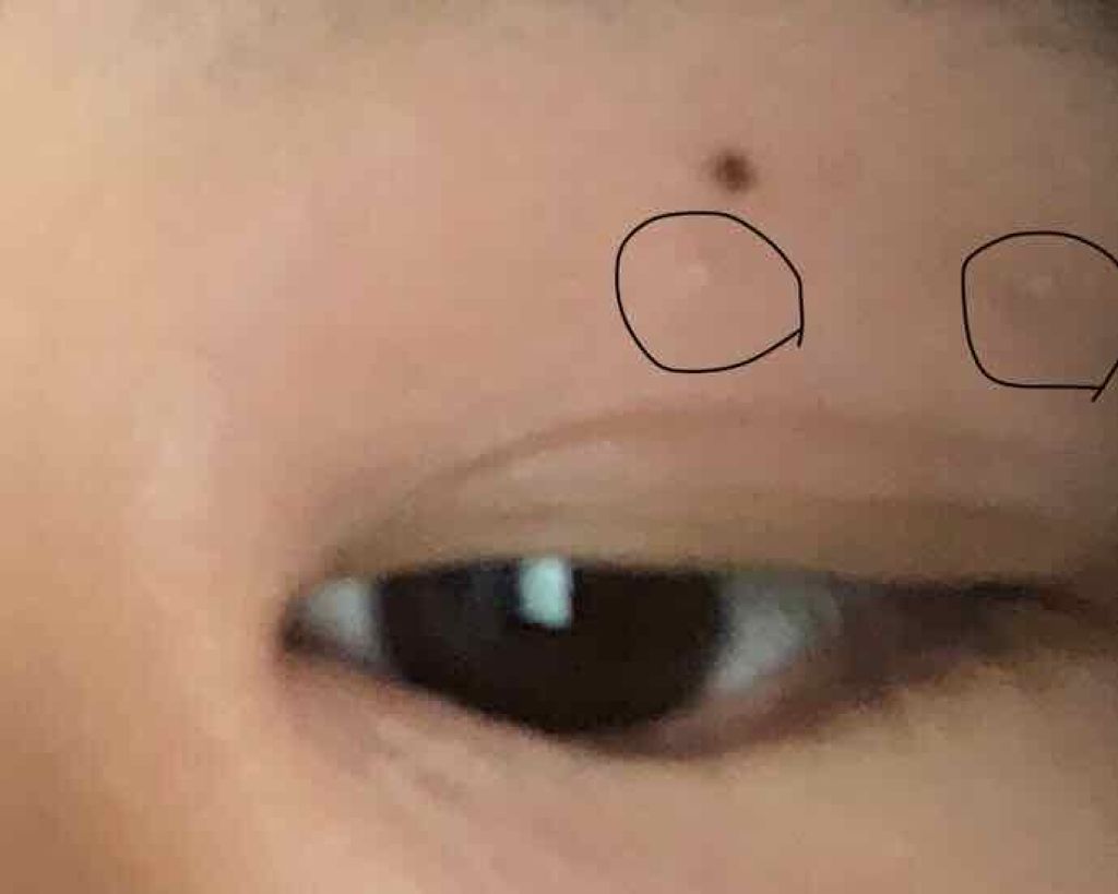 cocoro on LIPS 「メイクと関係ないんですが、写真にあるできものみたいなの何かわか..」(2枚目)