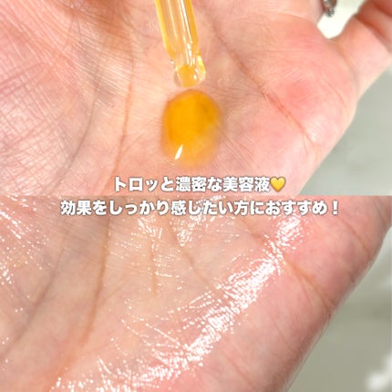 ミシャ ビタシープラス 美容液【日本処方】/MISSHA/美容液を使ったクチコミ(3枚目)