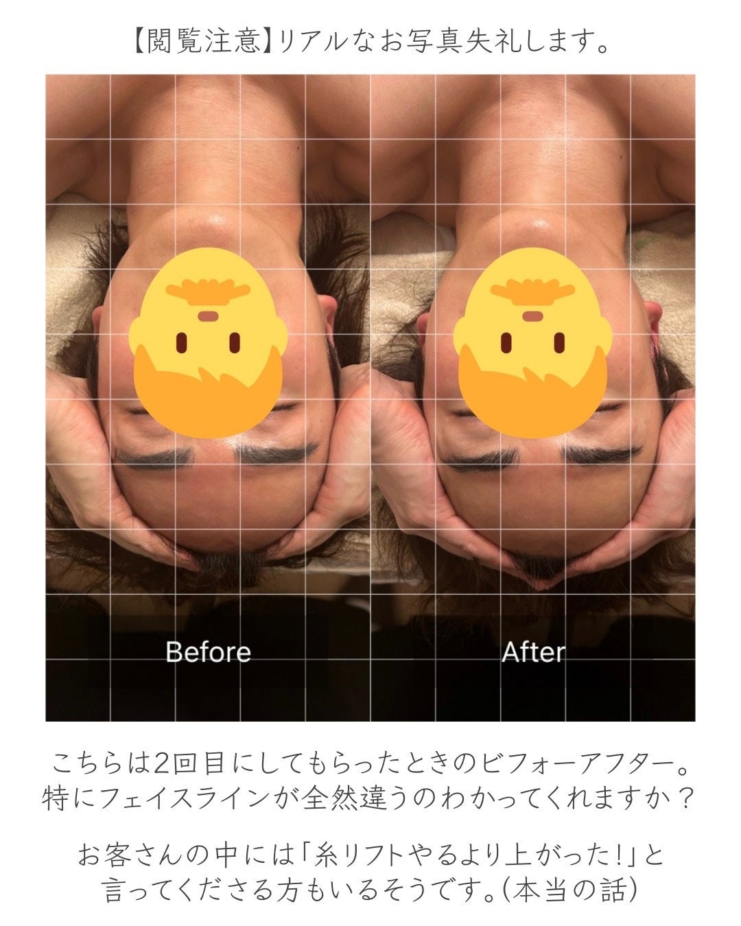 ヒロキ|40歳の美容家 ヘアケア スキンケア on LIPS 「銀座のドライヘッドスパ専門店SAWAEで施術したことをまとめま..」(5枚目)