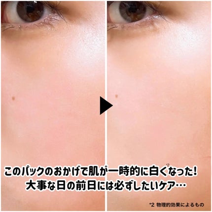 ãã¯ã€ããã¹ã¯N/éæçœè/ã·ãŒããã¹ã¯ã»ããã¯ã䜿ã£ãã¯ãã³ãïŒ5æç®ïŒ