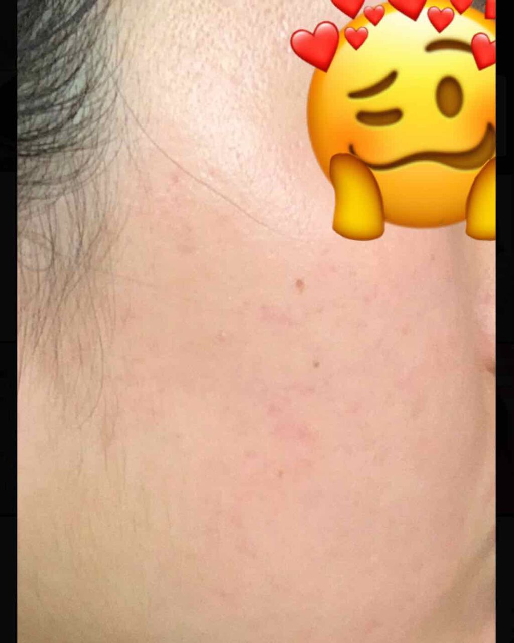 ハトムギ化粧水(ナチュリエ スキンコンディショナー R )/ナチュリエ/化粧水を使ったクチコミ(2枚目)