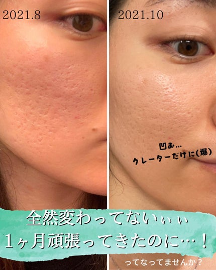 を使ったクチコミ(3枚目)