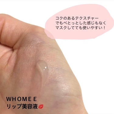 リップ美容液/WHOMEE/リップケア・リップクリームを使ったクチコミ（4枚目）