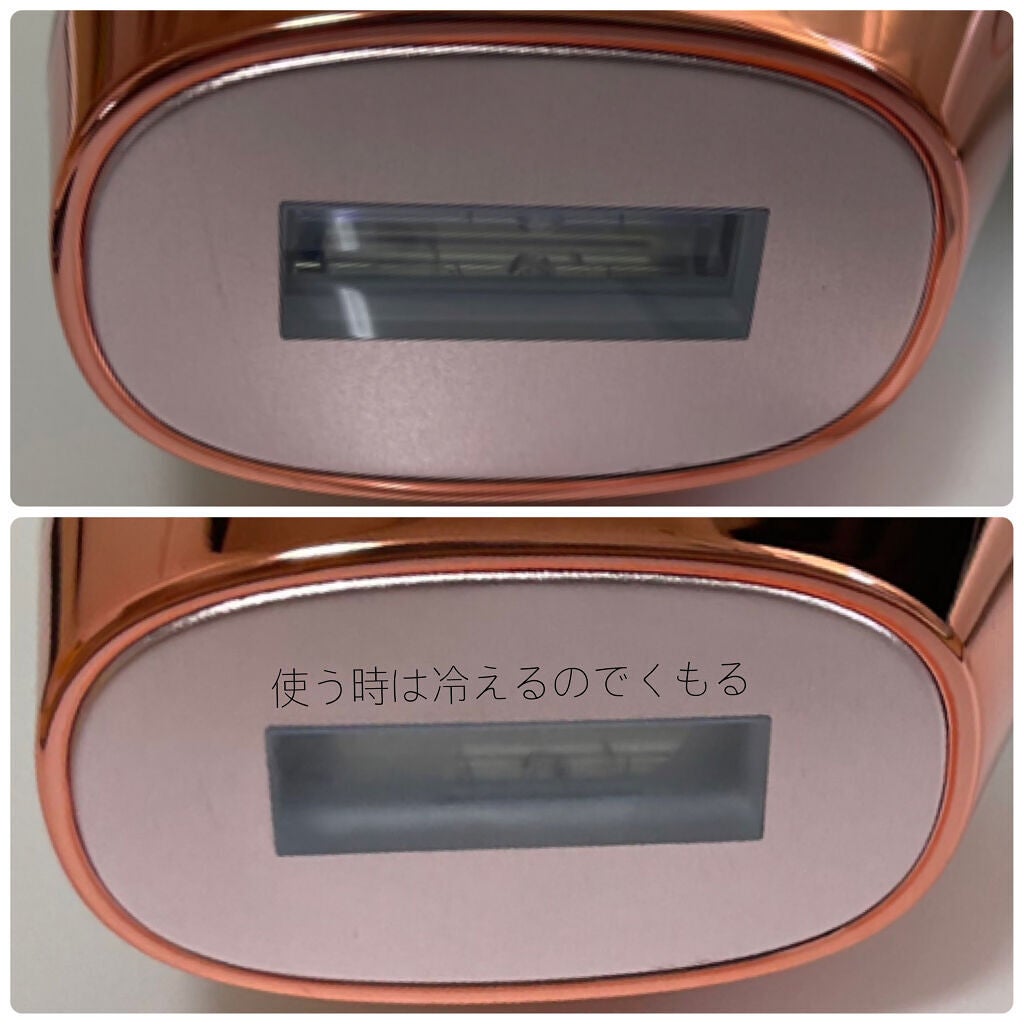 光脱毛器 VIO/Sarlisi/家庭用脱毛器を使ったクチコミ(7枚目)