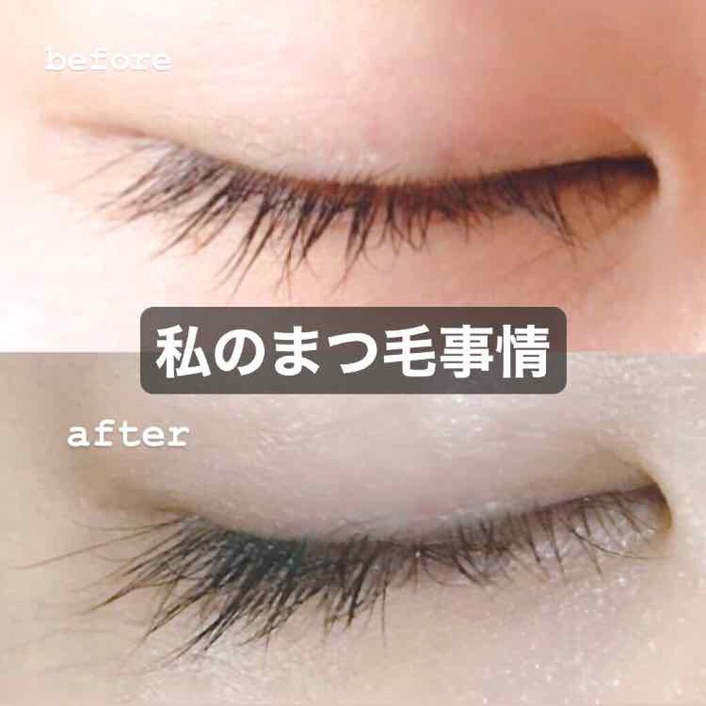 EMAKED（エマーキット）/水橋保寿堂製薬/まつげ美容液を使ったクチコミ（1枚目）