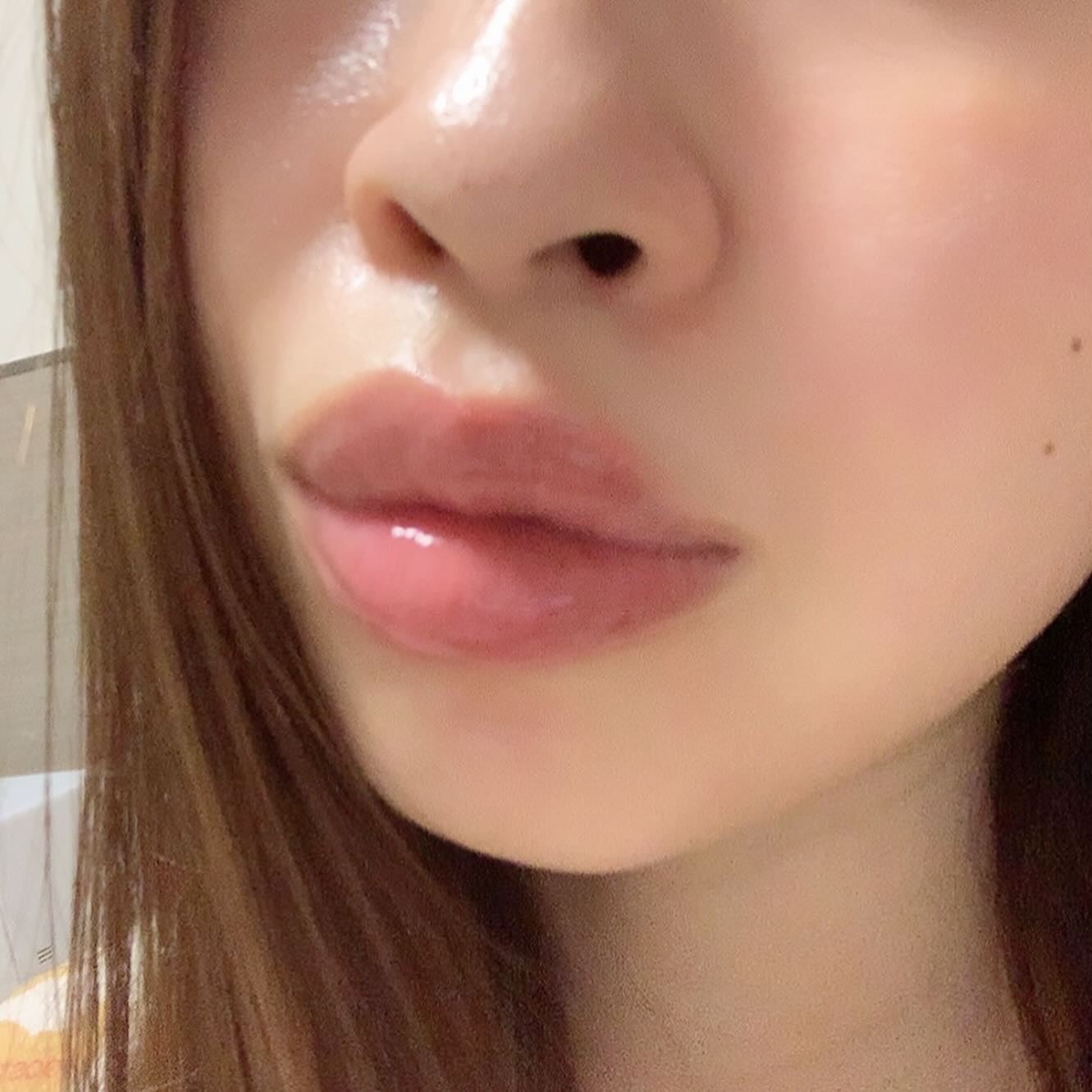 LIPS SHOT/MOTTO LAB./リップマスクを使ったクチコミ(4枚目)