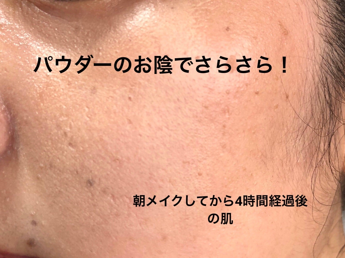 資生堂ベビーパウダー(プレスド)/ベビー/ボディパウダーを使ったクチコミ(6枚目)