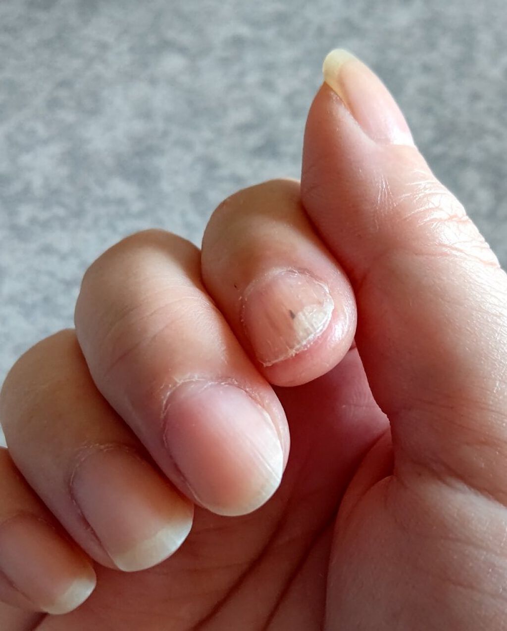 ネイルケアプロテクター/オルビス/ネイルオイル・トリートメントを使ったクチコミ（1枚目）