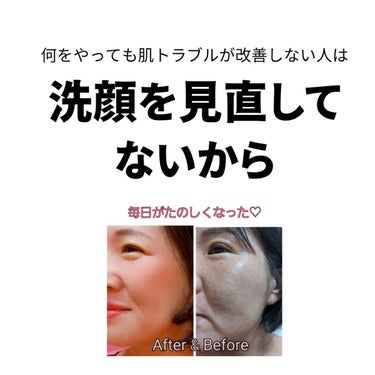 美肌カウンセラー💆綺麗のお助け相談所 on LIPS 「美肌菌を育てるスキンケア♡叶えたい肌になれないのは【洗顔を見直..」（2枚目）