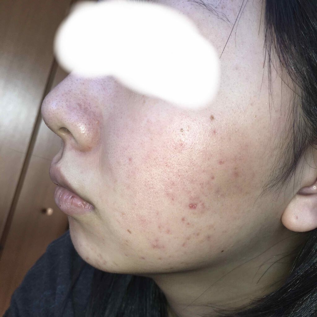 フワフワネコチャン on LIPS 「前回の投稿から約1週間毎日塗り続けてます〜気づいたんだがこれい..」(2枚目)