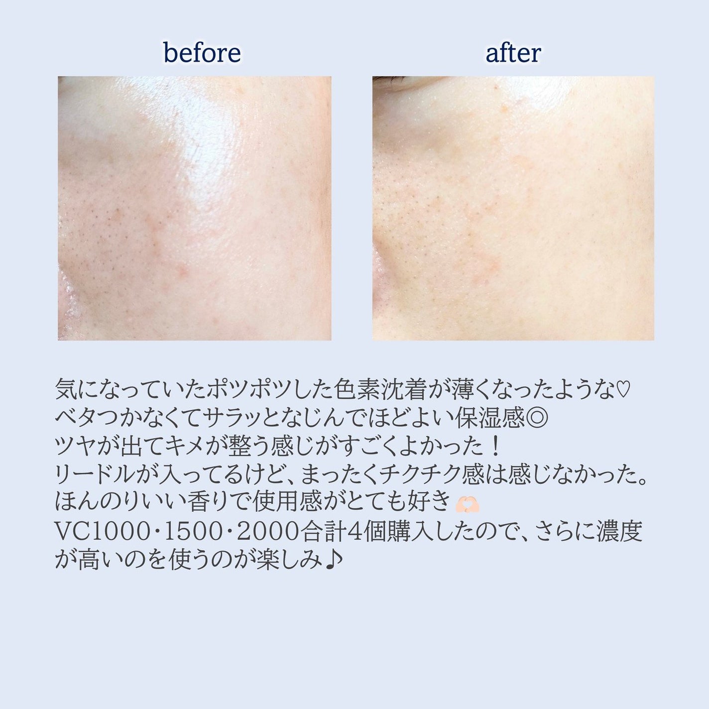 リードルショット100/VT/美容液を使ったクチコミ(5枚目)