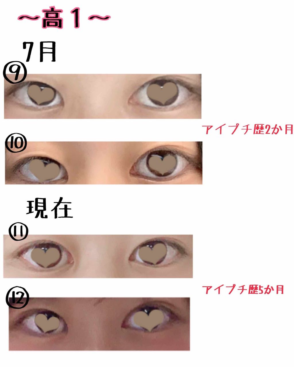 ワンダーアイリッドテープ Extra/D-UP/二重まぶた用アイテムを使ったクチコミ(4枚目)