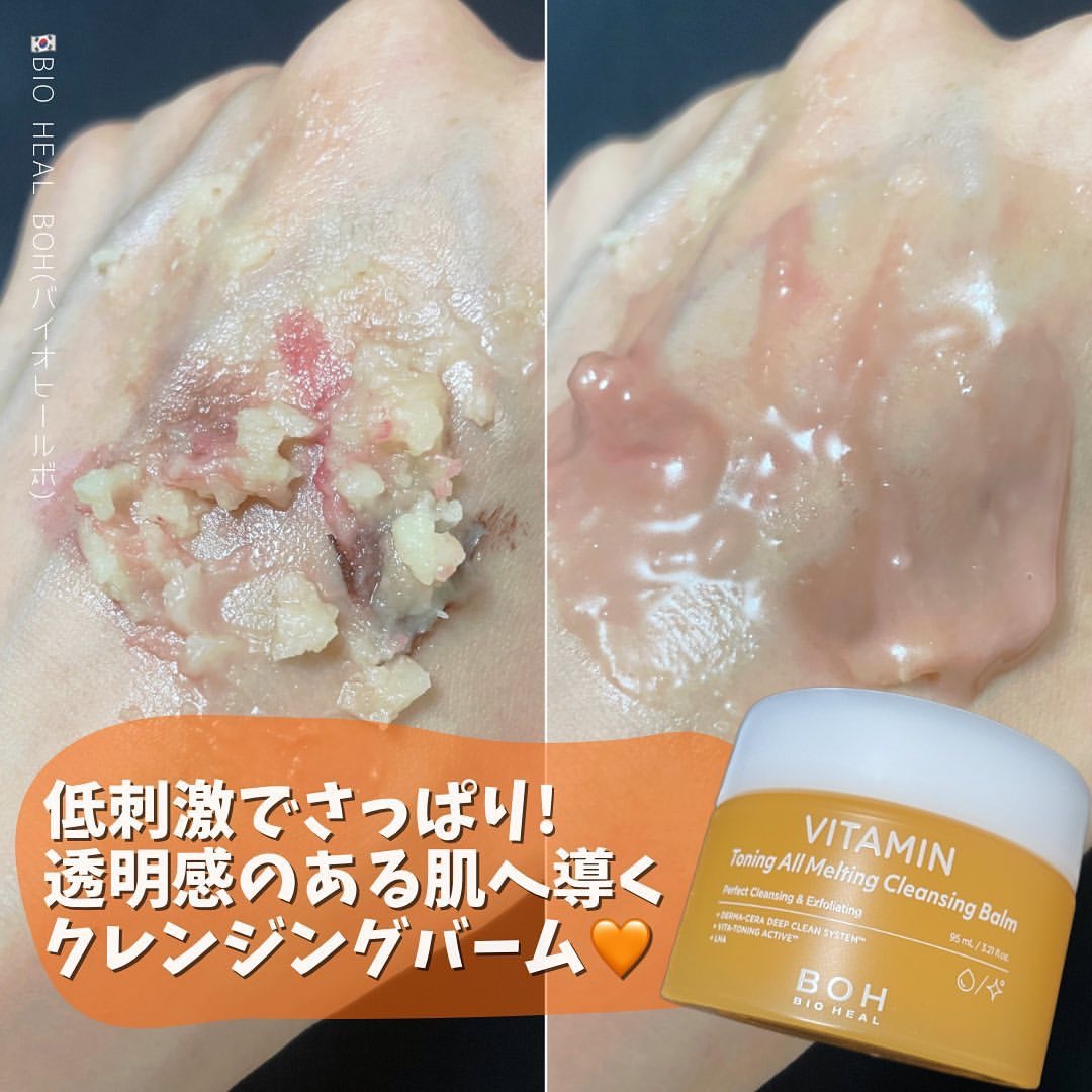 ビタミン トーニング オール メルティング クレンジングバーム/BIOHEAL BOH/クレンジングバームを使ったクチコミ（1枚目）