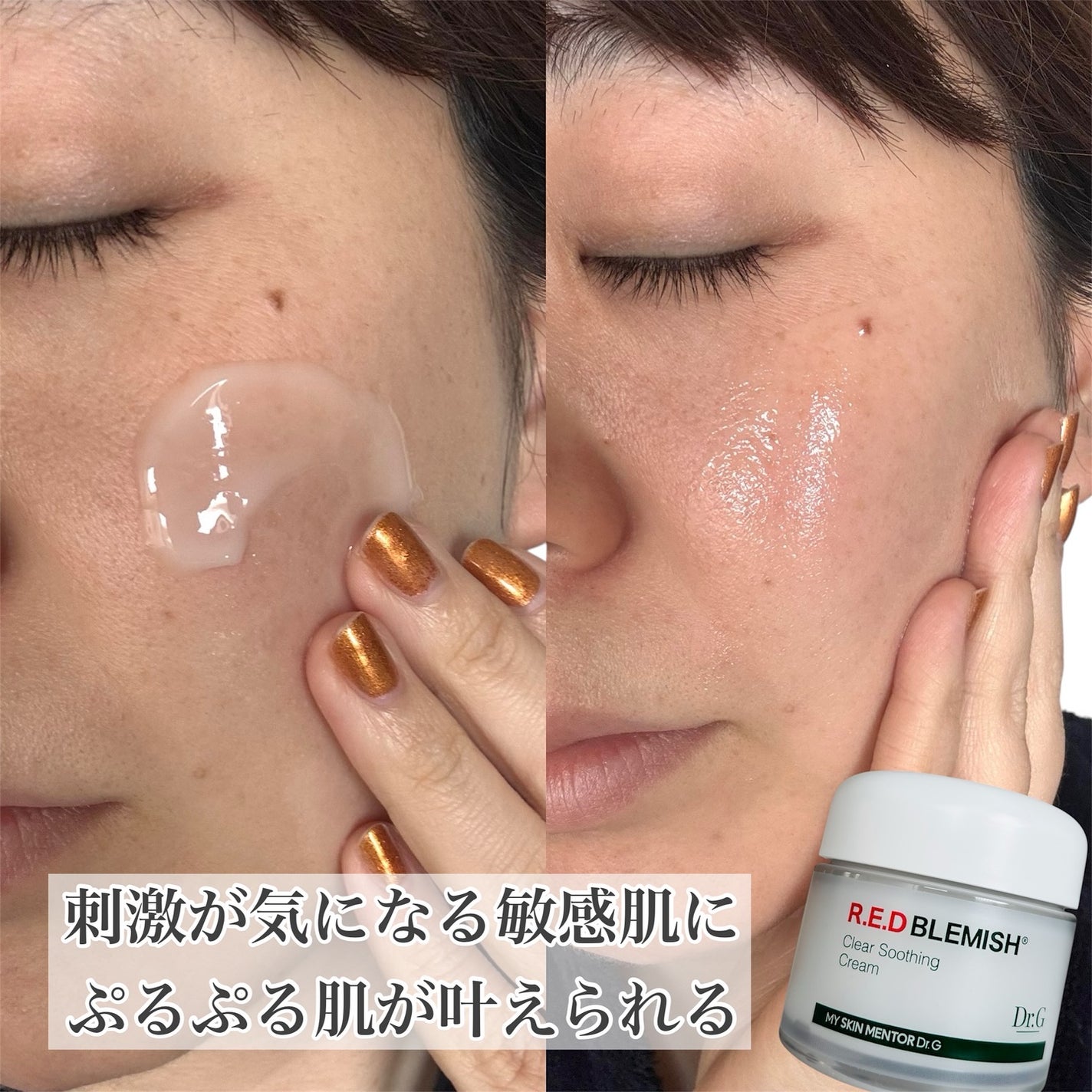 レッドブレミッシュ クリアモイスチャークリーム/Dr.G/フェイスクリームを使ったクチコミ(5枚目)