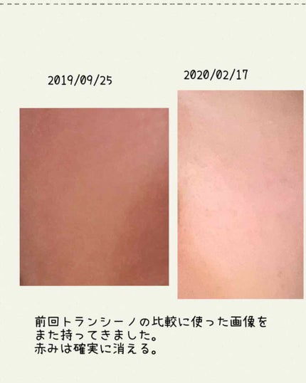 リポスフェリック ビタミンC(リポソーム ビタミンC)/Lypo-Spheric/美容サプリメントを使ったクチコミ(2枚目)