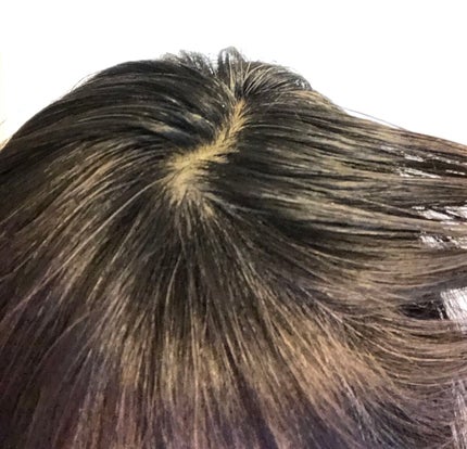 Wアプローチヘアプログラム/MUNOAGE(ミューノアージュ)/頭皮ローションを使ったクチコミ(9枚目)