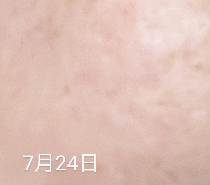 シカレチA エッセンス0.3/VT/美容液を使ったクチコミ（3枚目）