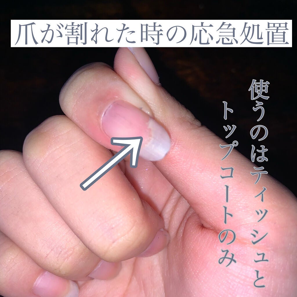 ガラスドロップジェルコート/MAJOLICA MAJORCA/ネイルトップコートを使ったクチコミ(1枚目)