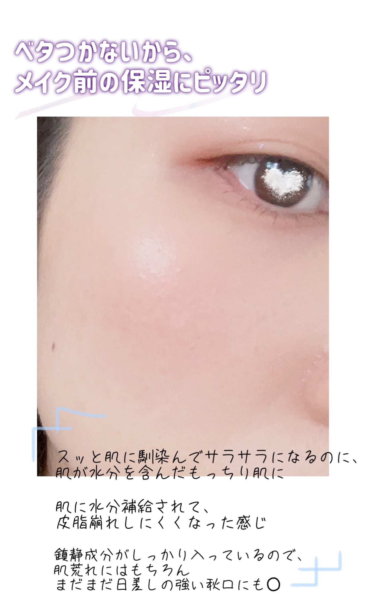 ピンクティーツリーシナジーセラム/APLIN/美容液を使ったクチコミ（3枚目）