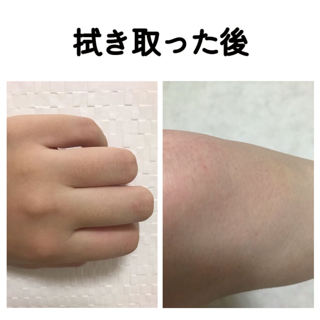 除毛クリーム シトラスホワイトリリィ/スリンキータッチ セルフスパ/除毛クリームを使ったクチコミ(5枚目)