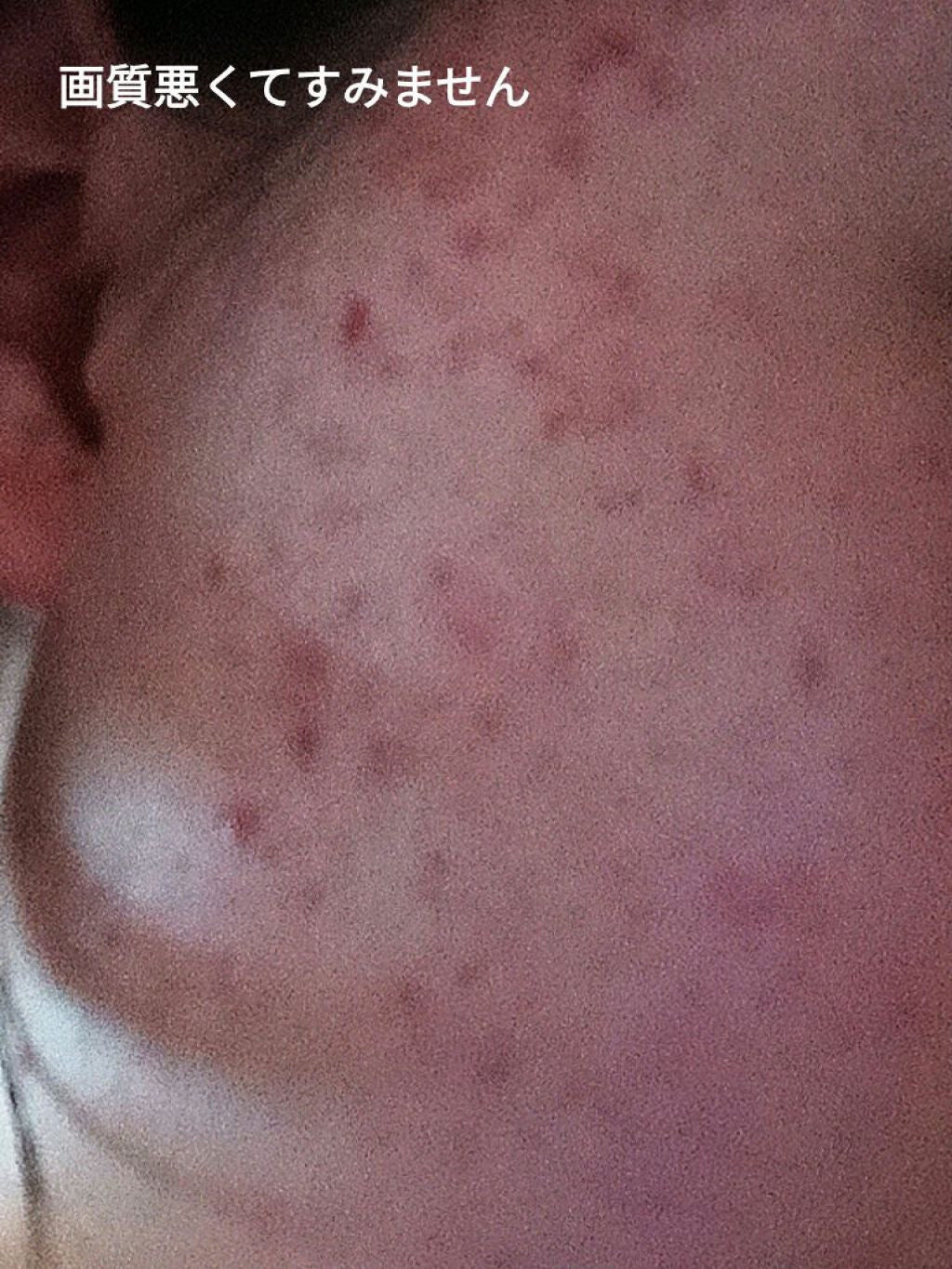 ハトムギ保湿ジェル(ナチュリエ スキンコンディショニングジェル)/ナチュリエ/美容液を使ったクチコミ(2枚目)