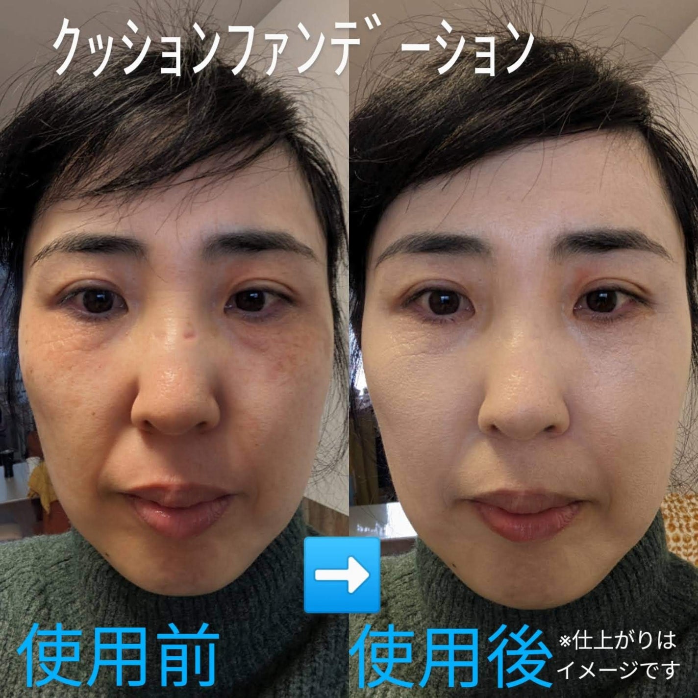 ダーマシンコンシーラー/23years old/リキッドコンシーラーを使ったクチコミ(9枚目)