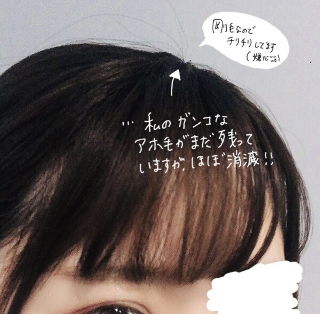 エルジューダ  ポイントケアスティック/エルジューダ/ヘアジェルを使ったクチコミ（3枚目）