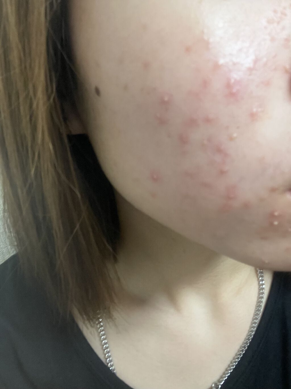 ハトムギ化粧水(ナチュリエ スキンコンディショナー R )/ナチュリエ/化粧水を使ったクチコミ（3枚目）