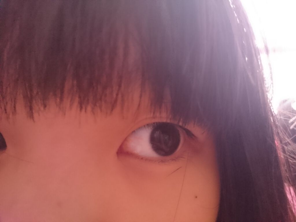 mana on LIPS 「2つとも同じアイプチをしましたが、こんな結果に…右目は何がダメ..」(1枚目)