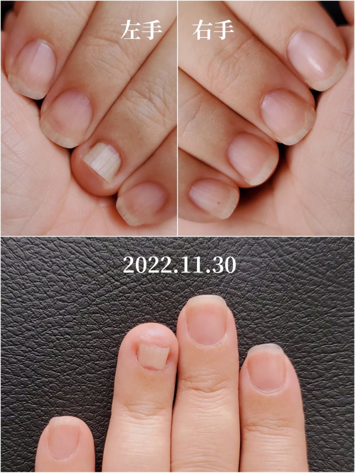 アンティセプト/LCN/ネイルオイル・トリートメントを使ったクチコミ（2枚目）