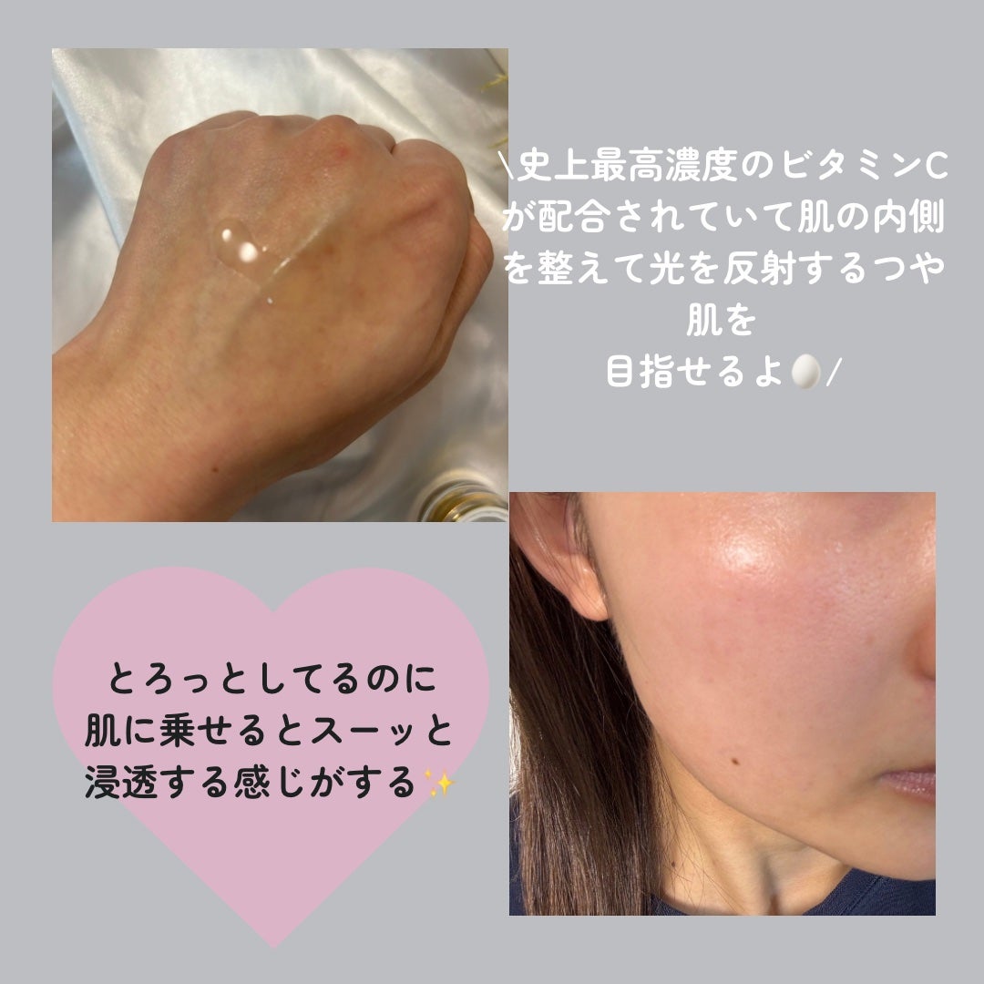 VC100エッセンスローション EX/ドクターシーラボⓇ/化粧水を使ったクチコミ(3枚目)